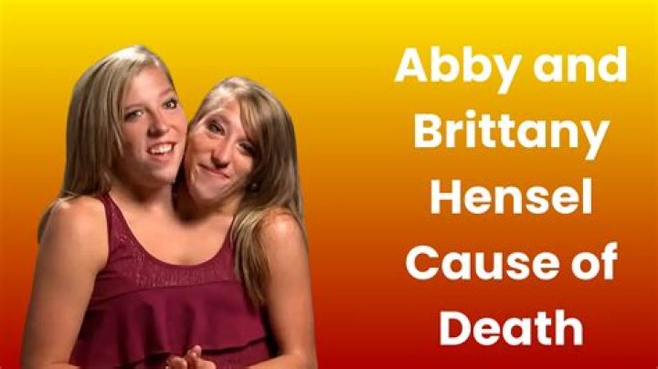 Abby and Brittany Hensel Cause of Death: A Comprehensive Exploration