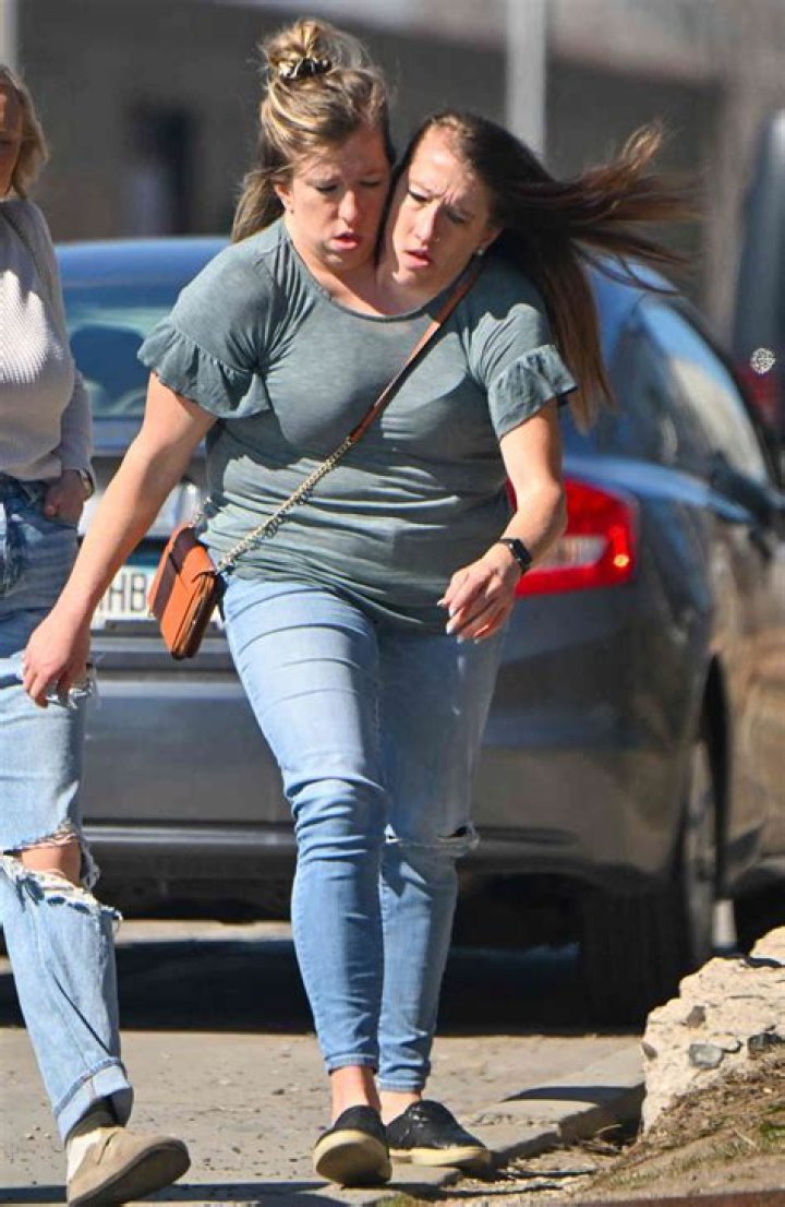 Abby Conjoined Twin Dies: A Heartbreaking Journey and Legacy