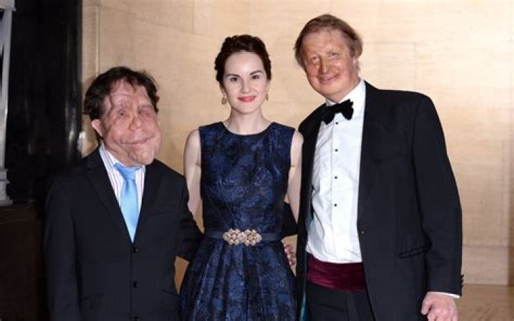 Adam Pearson Wife: A Comprehensive Look into Their Relationship and Life Together