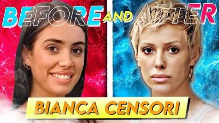 Bianca Censori and Plastic Surgery: The Untold Story