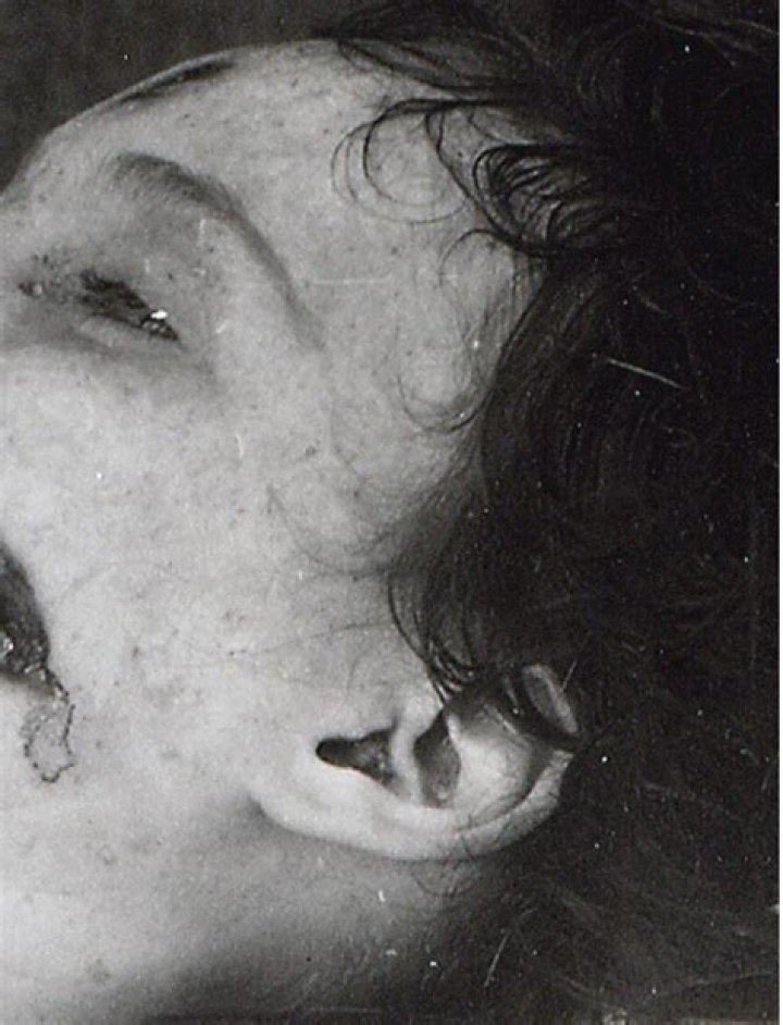 Unveiling the Mystery: The Real Body of the Black Dahlia
