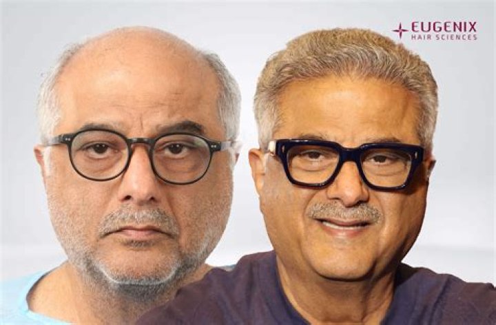 Boney Kapoor Hair: A Comprehensive Guide to Style, Care, and Expert Tips