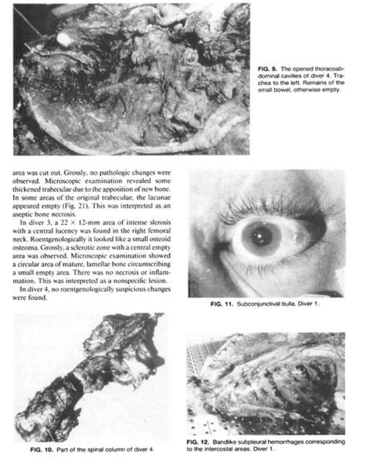 Exploring the Fascinating World of Byford Dolphin Diving Bell