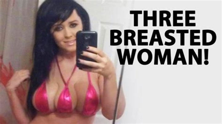 Can a Woman Have 3 Breasts? Exploring the Science, Myths, and Realities