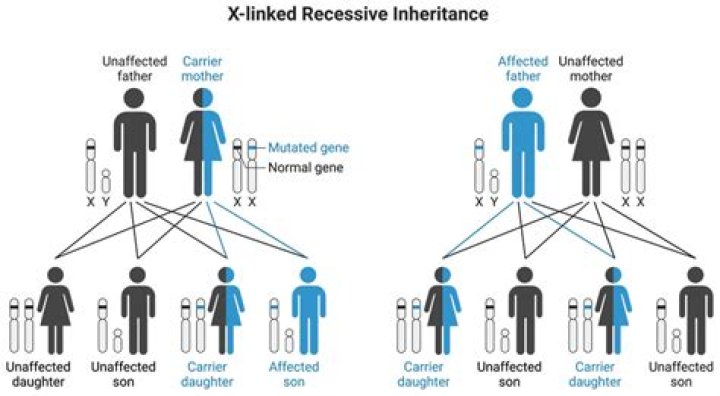 Caroline Kennedy Inheritance: A Comprehensive Guide to Her Wealth and Legacy