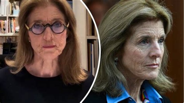 Caroline Kennedy Wrinkles: Embracing Grace and Wisdom with Age