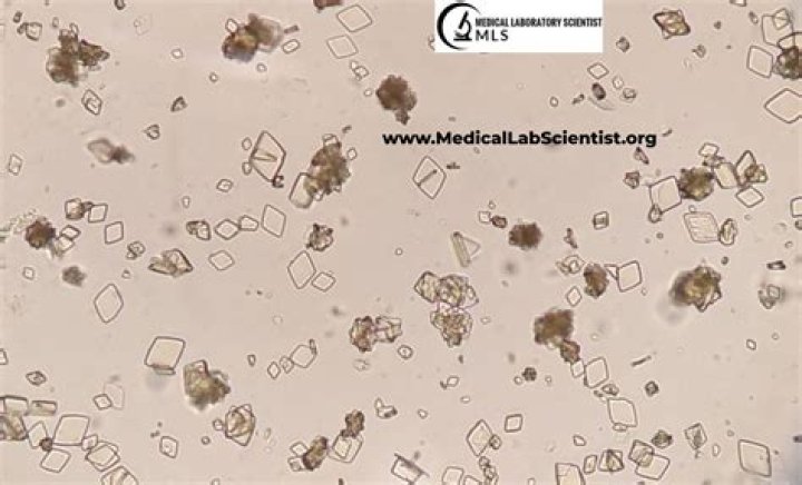 Cat Pee Crystals on Carpet: The Ultimate Guide to Identification and Removal