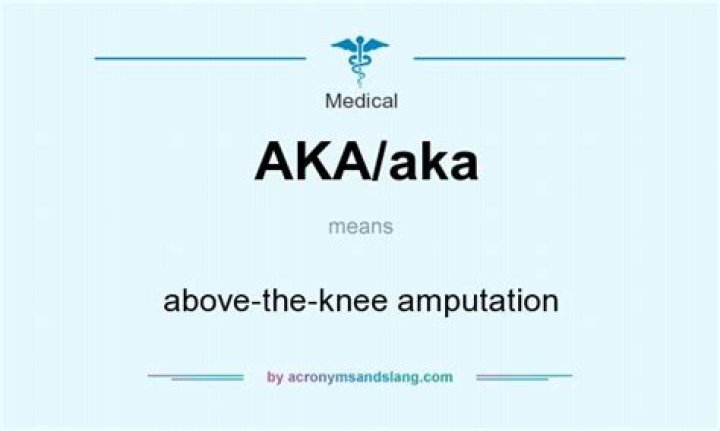 Definition of AKA: Understanding the Term and Its Various Applications