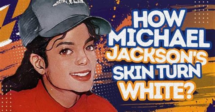 Did Michael Jackson Bleach His Skin? Unveiling the Truth Behind His Skin Color Transformation