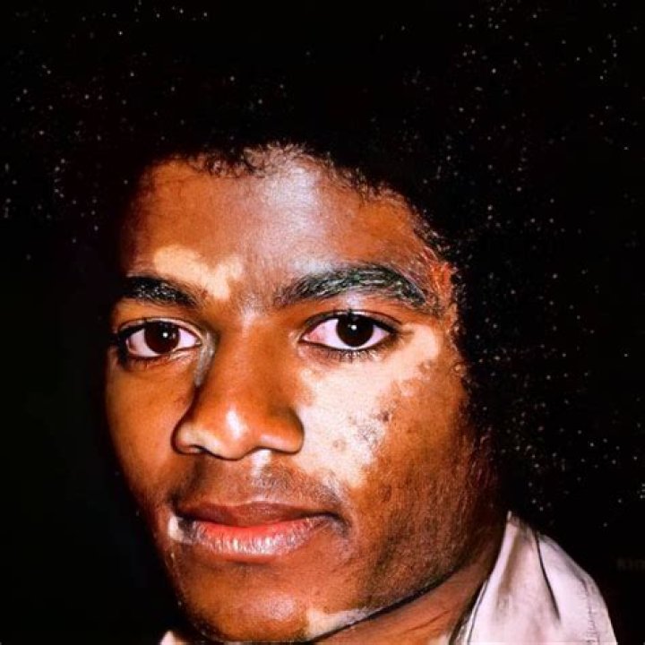 Did Michael Jackson Change His Skin Color? Unveiling the Truth