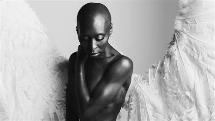 Does Cynthia Erivo Have Alopecia? Uncovering the Truth Behind the Rumors