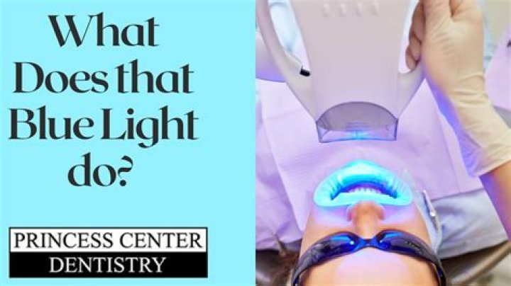 Does the Blue Light Whiten Teeth? A Comprehensive Guide to Understanding Its Effectiveness