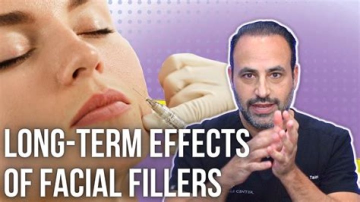 Exploring the Long-Term Effects of Fillers: What You Need to Know