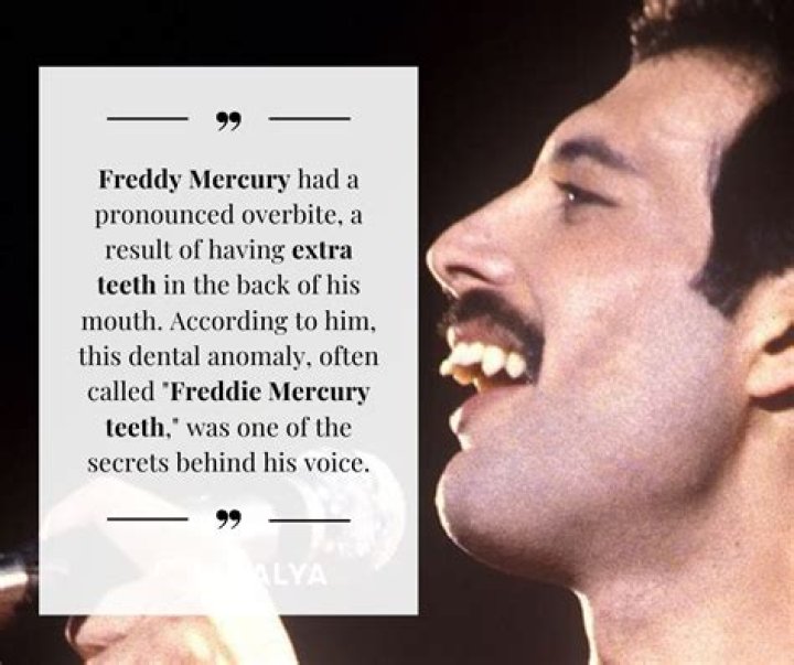 Freddie Mercury: The Fascinating Truth About His Extra Teeth