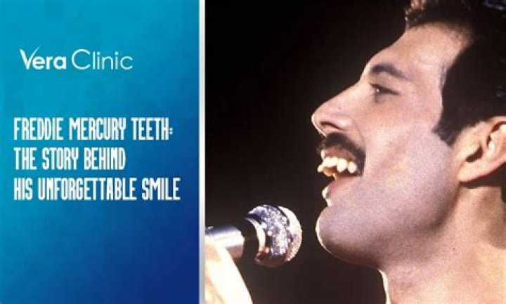 Unveiling Freddie Mercury's Iconic Teeth: The Story Behind the Legend