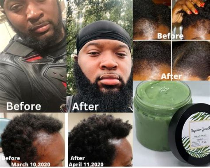 Hair Grease for Black Hair Growth: The Ultimate Guide to Promoting Strong, Healthy Hair