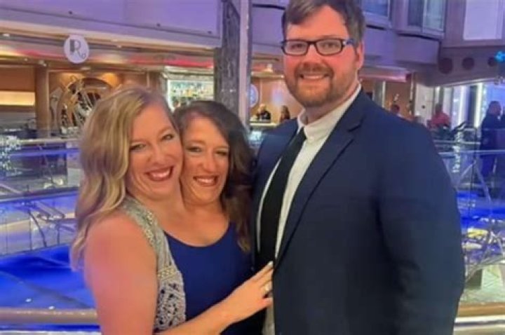 Hensel Twins: The Extraordinary Story That Captures Hearts Worldwide