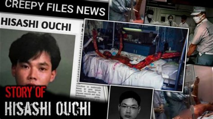 Hisashi Ouchi Real Photos: The Tragic Story Behind the Images