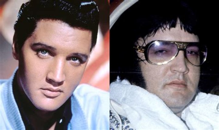 How Did Elvis Die: Unveiling the Truth Behind the King of Rock 'n' Roll's Passing