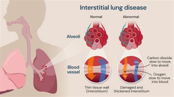 How Old Is Drake: Exploring the Life and Career of the Global Superstar