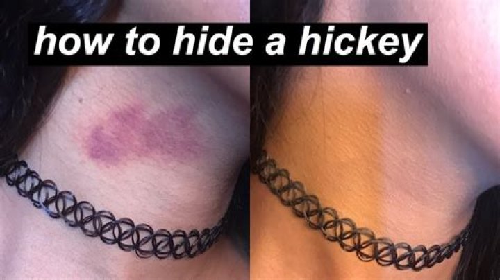 How to Cover a Hickey: The Ultimate Guide for Flawless Skin