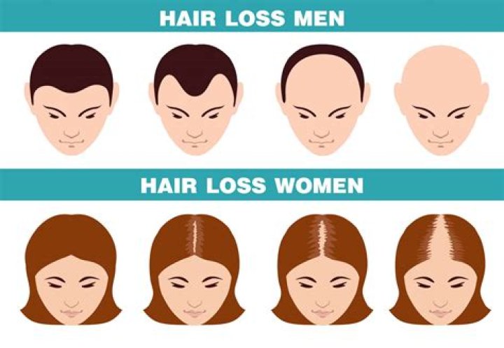 Is Hair Loss a Side Effect of Semaglutide? Unveiling the Truth