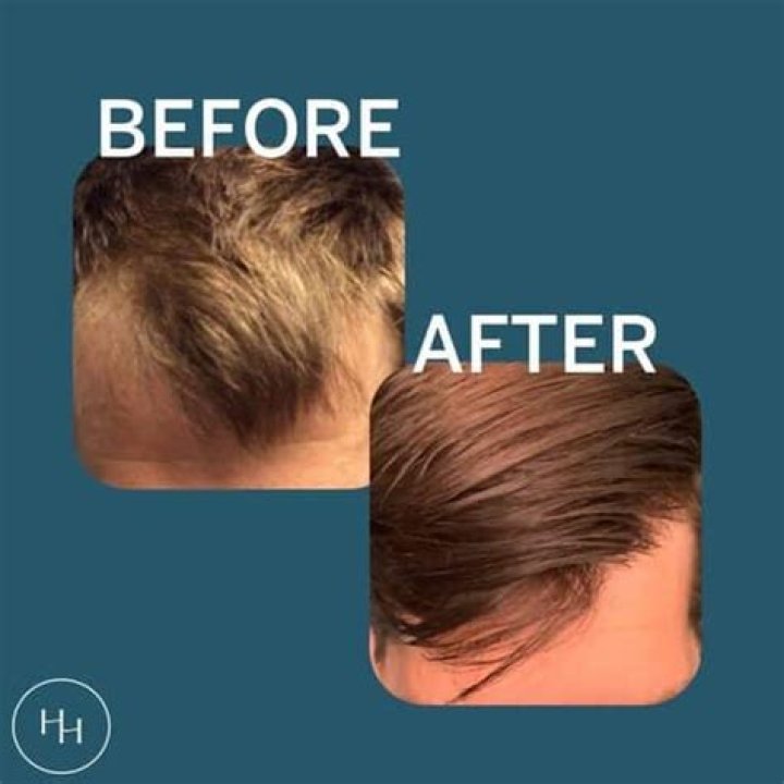 Is Happy Head Legit? Unveiling the Truth Behind This Revolutionary Hair Care Solution