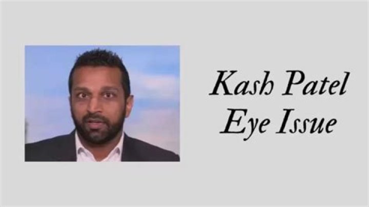 Kash Patel Eye: A Comprehensive Look into the Rising Star