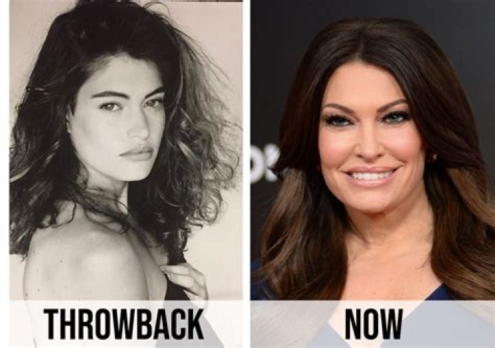 Kimberly Guilfoyle Plastic Surgery Face: Unveiling the Truth and Expert Insights