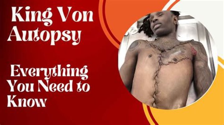 King Von Autopsy Cause of Death: Unveiling the Truth Behind the Tragic Loss
