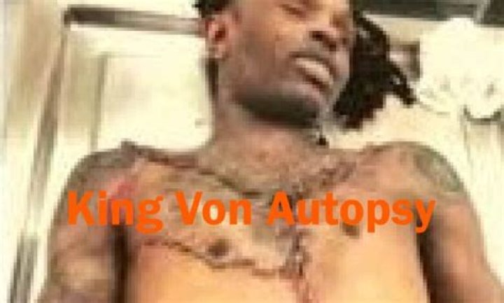 King Von Autopsy Picture: Unveiling the Truth Behind the Late Artist's Legacy