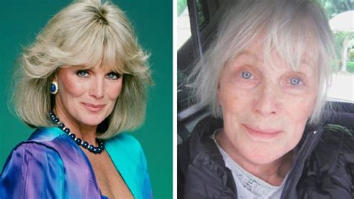 Linda Evans Today: Unveiling the Life, Career, and Legacy of a Beloved Icon
