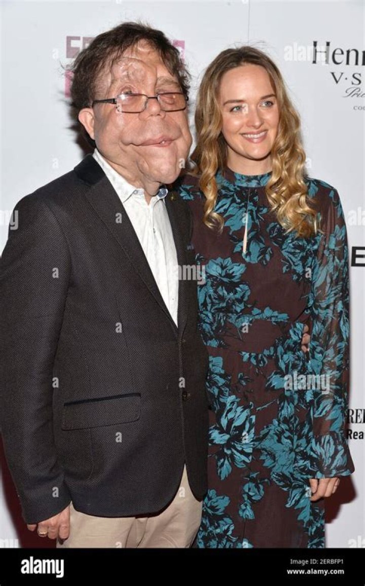 Lovetory Adam Pearson and His Dedicated Wife: A Heartfelt Journey