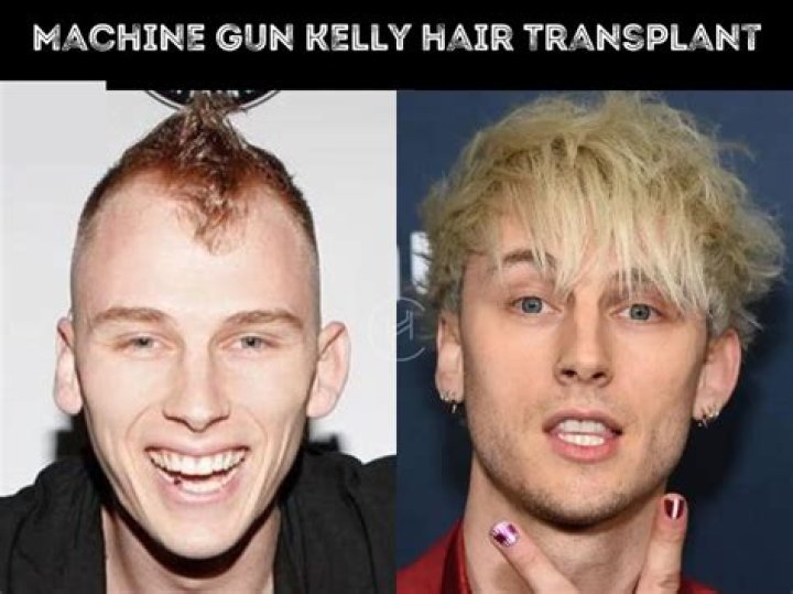 Machine Gun Kelly's Age: A Comprehensive Look into the Life and Career of the Renowned Artist
