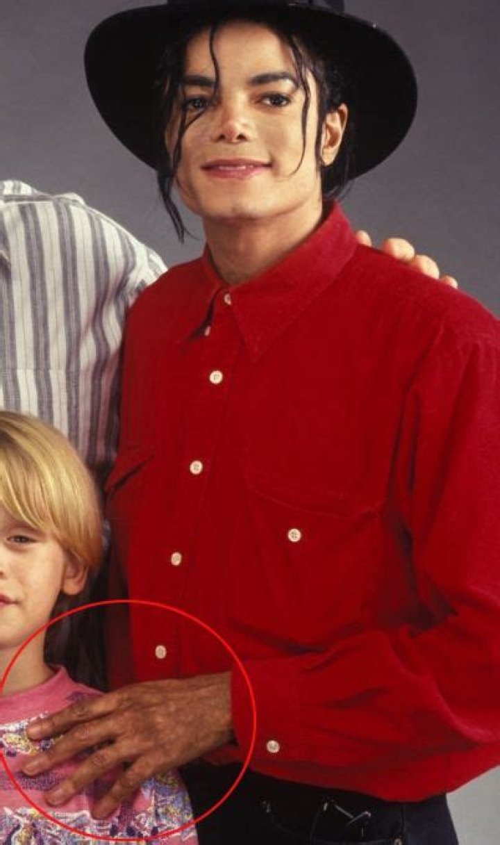 Michael Jackson and Vitiligo: A Comprehensive Exploration of the King of Pop's Journey