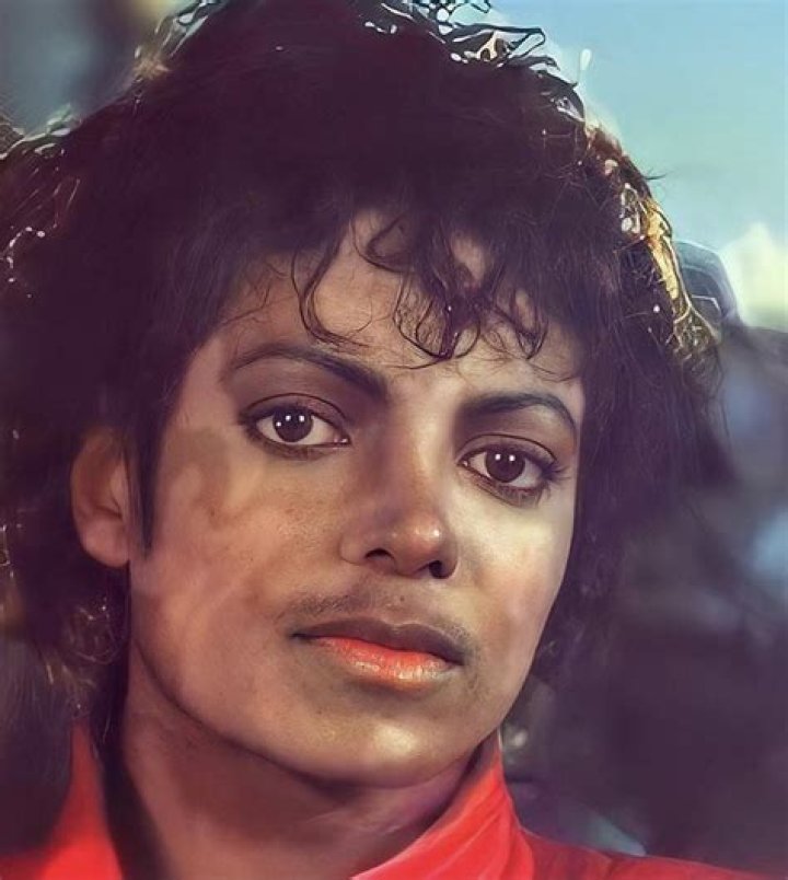 Michael Jackson's Medical Condition: A Comprehensive Insight