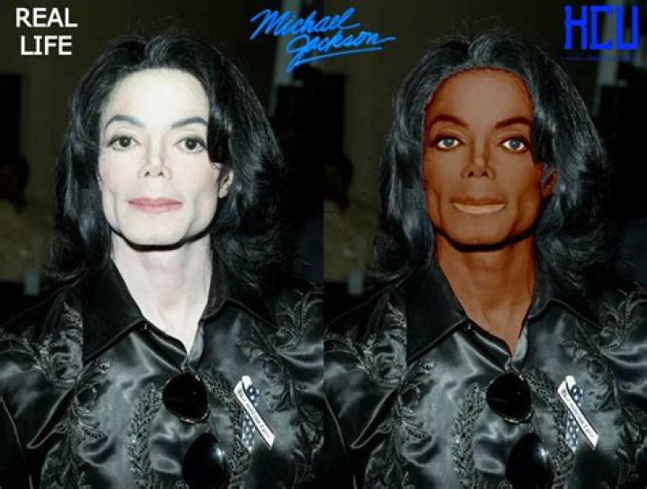 Michael Jackson Vitiligo Evolution: The Journey of an Icon