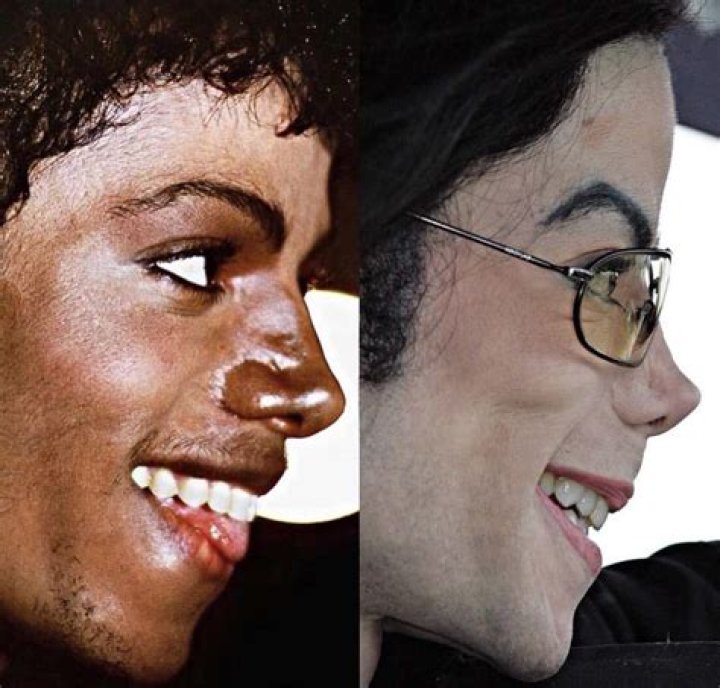 Michael Jackson's Condition: Exploring the Health Battles of a Legend