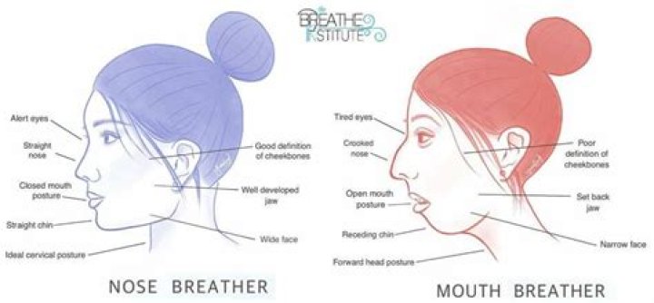 Mouth Breather Jawline: Understanding the Impact and Solutions