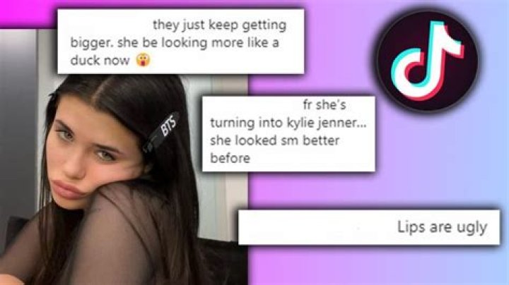 Nessa Barrett Lips: The Complete Guide to Her Signature Style