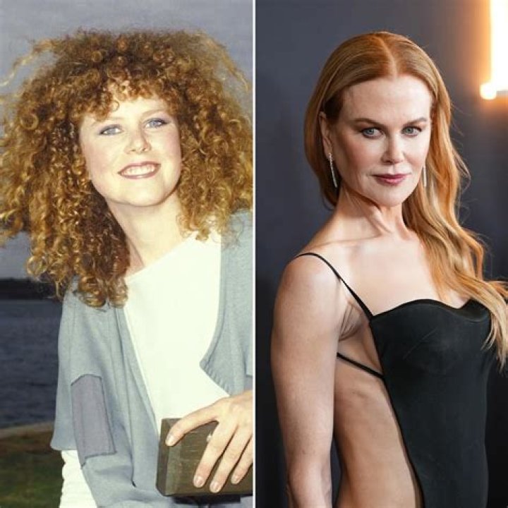 Nicole Kidman Face Work: Unveiling the Truth Behind Her Transformation