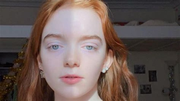 Orla Baxendale: The Rising Star Who Captivates Audiences Worldwide