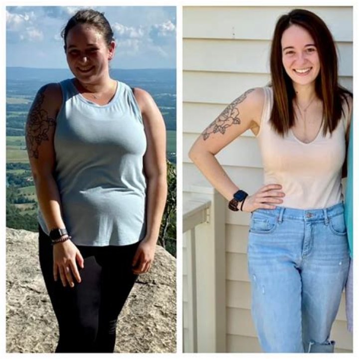 Ozempic Before and After: Transforming Lives Through Weight Loss and Diabetes Management