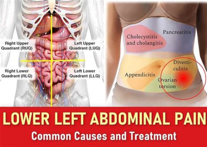 Pain with Cough in Lower Left Abdomen: Causes, Symptoms, and Treatments