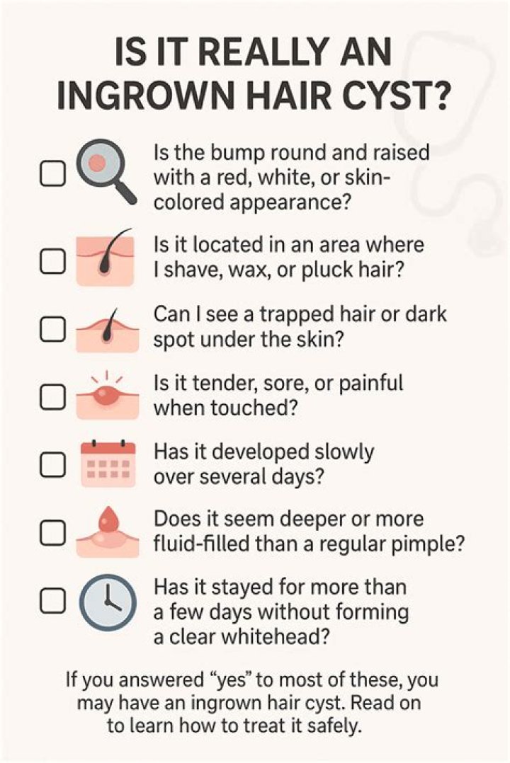 Photo of Ingrown Hair Cyst: A Comprehensive Guide to Understanding and Treating Ingrown Hair Cysts