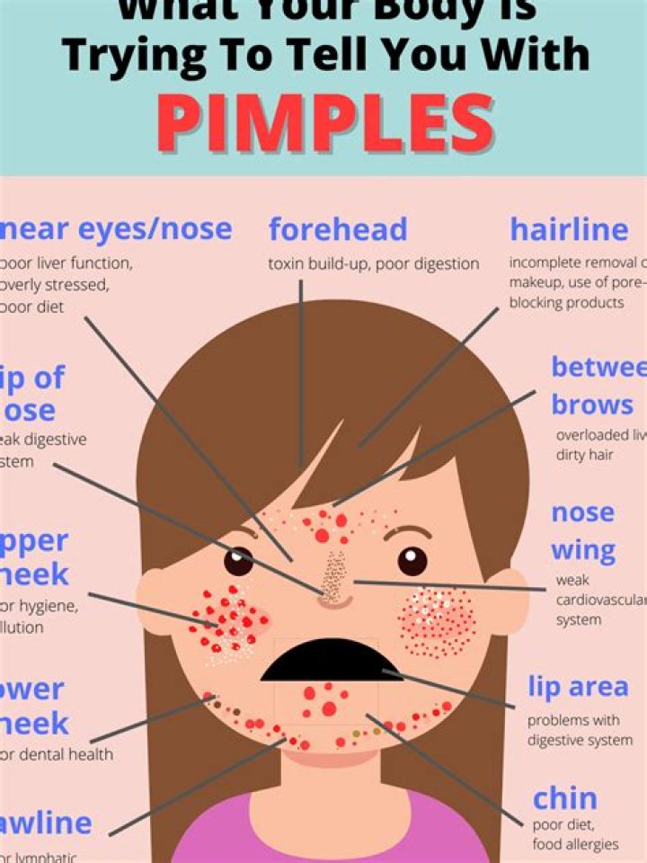 Pimple in Eyebrow: Causes, Treatments, and Prevention Tips