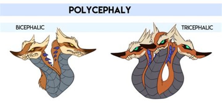 Polycephaly in Humans: Exploring the Rare Phenomenon and Its Implications