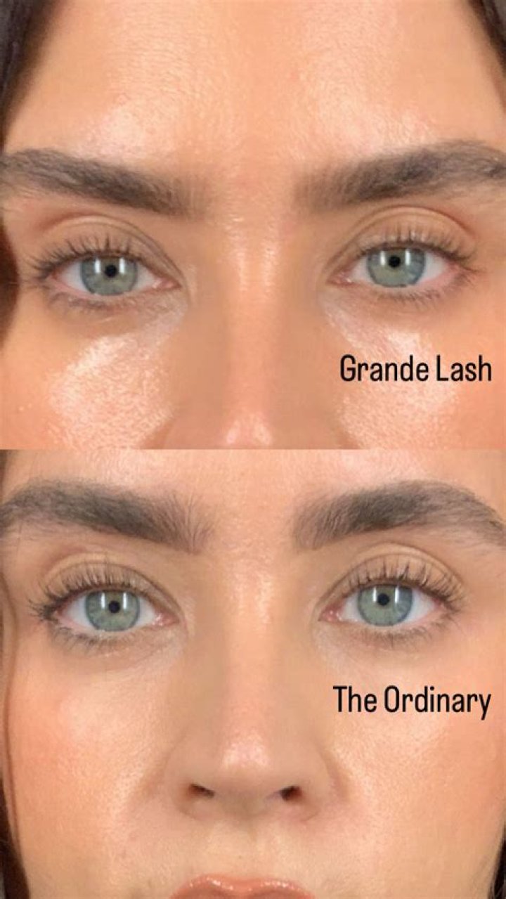 Side Effects of GrandeLash Results: What You Need to Know