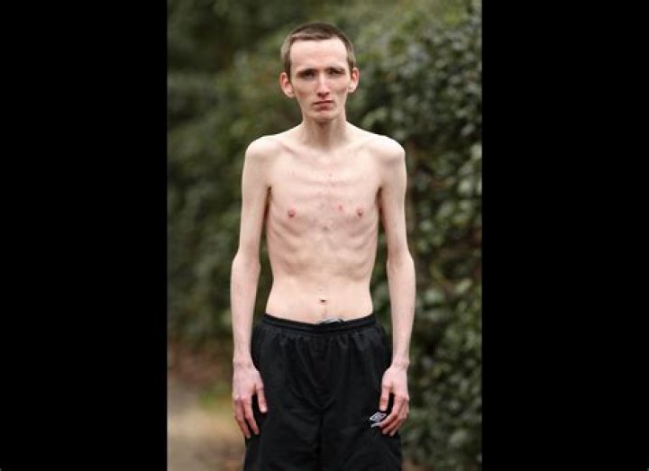 The Skinniest People Alive: Unveiling Their Stories, Struggles, and Triumphs