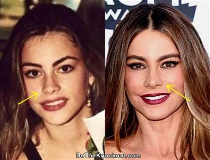 Sofia Vergara Nose Job: The Truth Behind Her Iconic Look